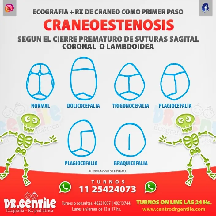 Ecografía pediátrica, centro de Diagnóstico Dr. Gentile.-